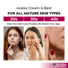 Acne Treatment Cream with Azelaic Acid – Gently Exfoliates & Brightens Skin