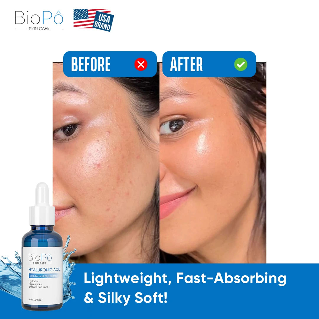 Anti-Aging Hyaluronic Acid Serum – Reduces Fine Lines & Restores Skin Elasticity