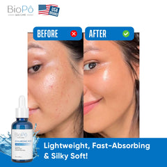 Anti-Aging Hyaluronic Acid Serum – Reduces Fine Lines & Restores Skin Elasticity