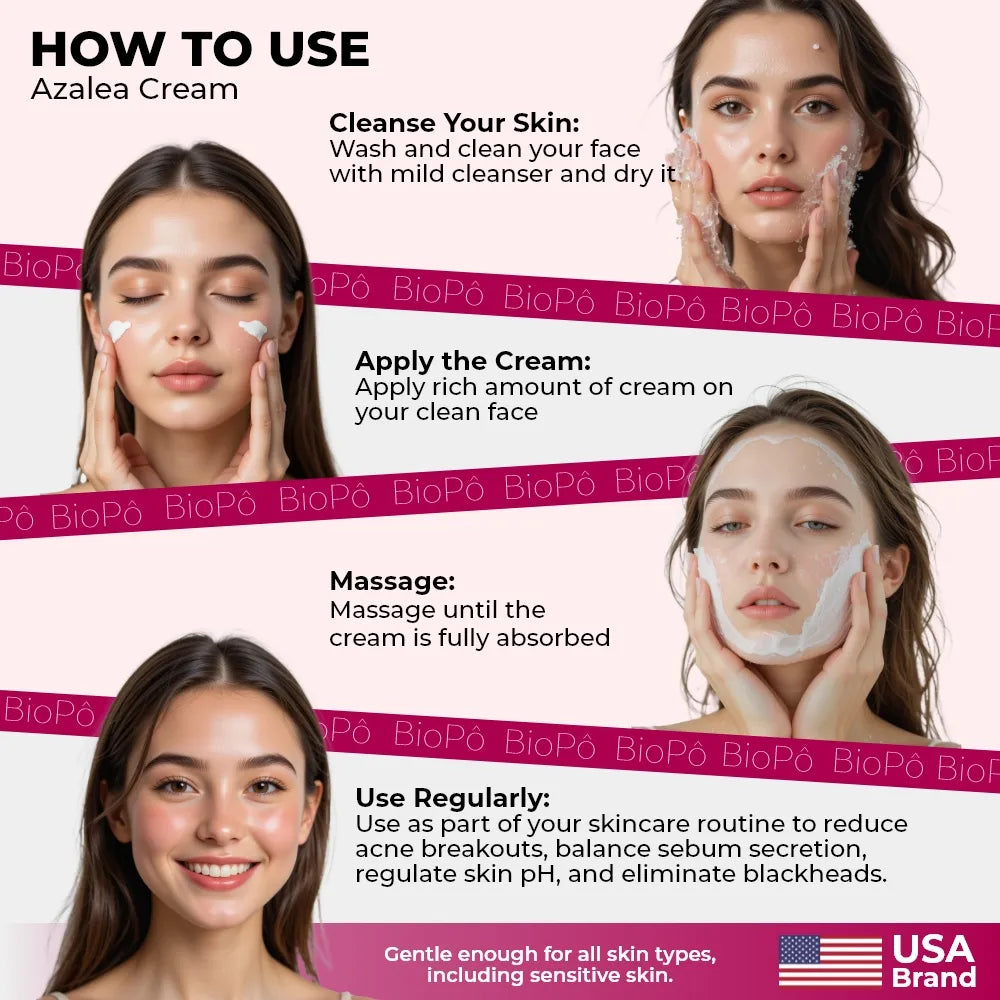 Azalea Acne Cream – Lightweight, Non-Irritating Formula for Sensitive Skin