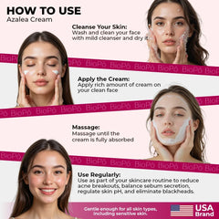 Azalea Acne Cream – Lightweight, Non-Irritating Formula for Sensitive Skin
