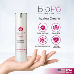 Azalea Acne Treatment Cream – Clears Breakouts & Restores Skin Confidence