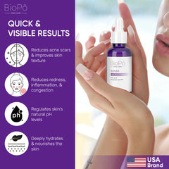 BioPo Azalea Acne Treatment Serum – delivers quick results by reducing pimples, blackheads, and blemishes