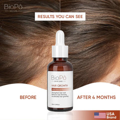 Fast Hair Growth Serum – BioPo Formula for Rapid Hair Regrowth and Deep Scalp Nourishment