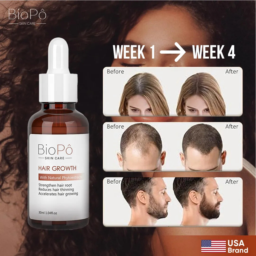 BioPo Hair Growth Serum – Clinically Proven Formula for Thicker, Fuller, and Stronger Hair