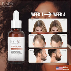 BioPo Hair Growth Serum – Clinically Proven Formula for Thicker, Fuller, and Stronger Hair