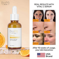 Skincare serum bottle with before and after skin results and oranges.