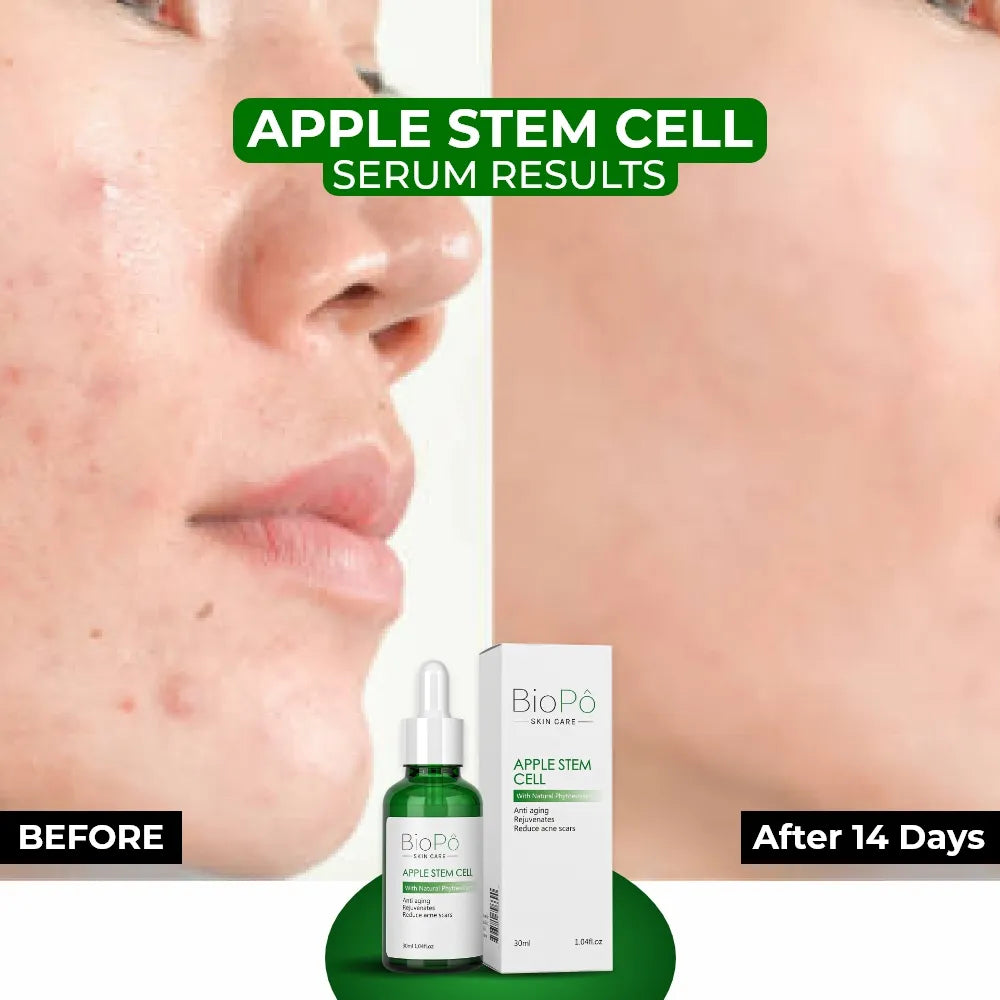 Plant-Based Apple Stem Cell Serum – Natural Skincare for Firm & Smooth Skin