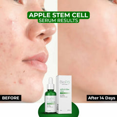 Plant-Based Apple Stem Cell Serum – Natural Skincare for Firm & Smooth Skin