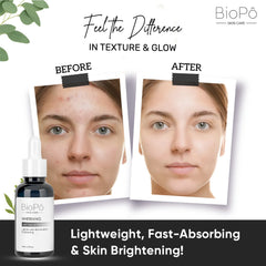BioPo Skin Brightening Whitening Serum – fades dark spots and evens skin tone for radiant glow