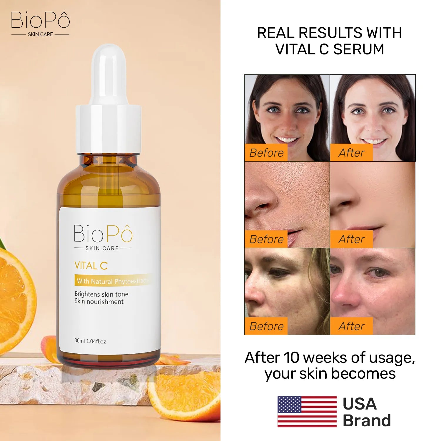 Skincare serum bottle with before and after skin results and oranges.